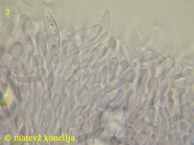 Ascocoryne cylichnium - celice na robu apotecija