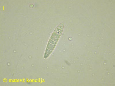 Ascocoryne cylichnium - Spore
