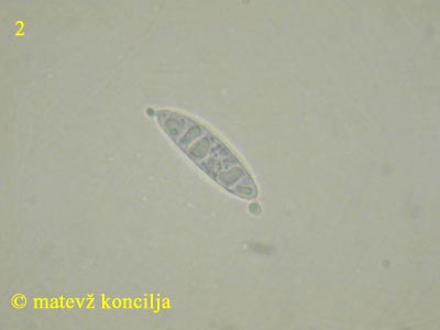 Ascocoryne cylichnium - Spore