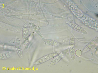 Ascocoryne cylichnium - Sporen