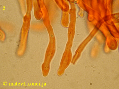 Ditiola peziziformis - Haare