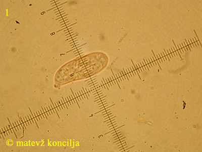 Ditiola peziziformis - Spore