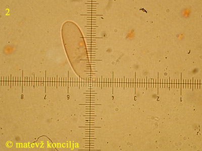 Ditiola peziziformis - Spore