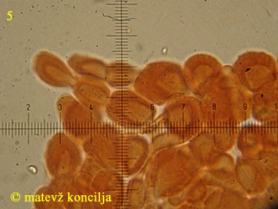 Guepiniopsis buccina - Haare
