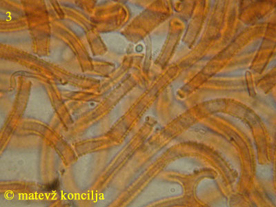 Guepiniopsis buccina - hife