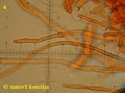 Guepiniopsis buccina - Hyphen