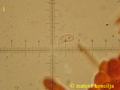Guepiniopsis buccina - Spore
