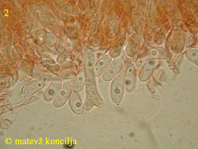 Guepiniopsis buccina - Sporen