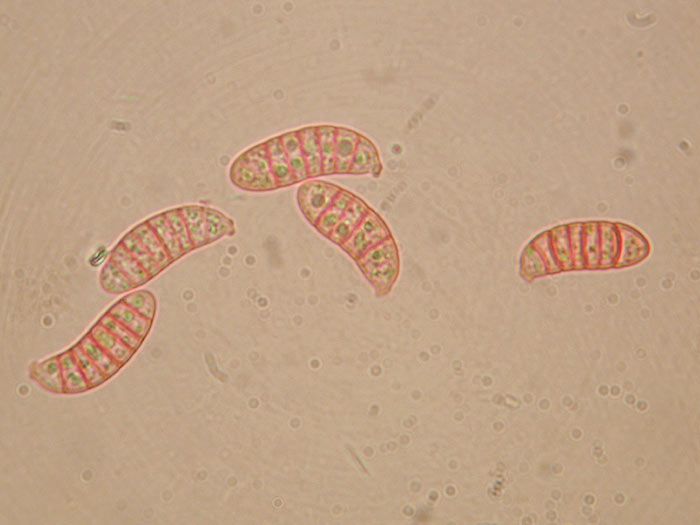 Sporen von Dacrymyces chrysospermus