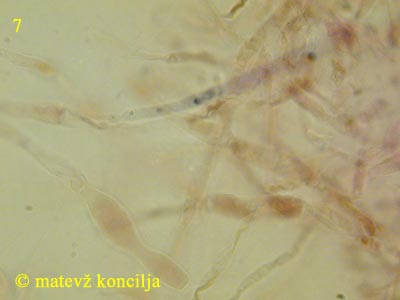 Russula densifolia - Dermatozystide