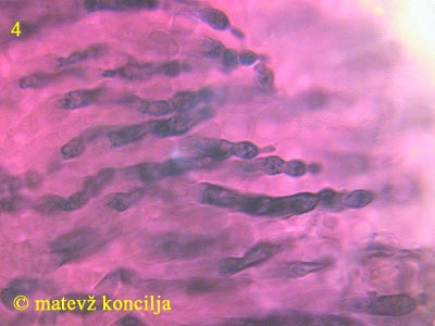 Russula densifolia - Pleurozystiden
