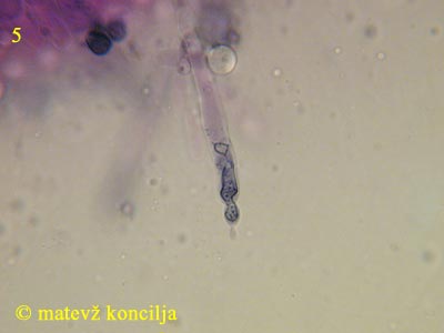 Russula densifolia - Pleurozystide