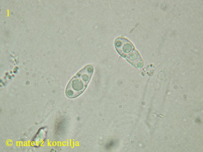 Sphaeria detrusa - askospore
