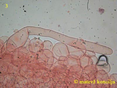 Coprinellus disseminatus - Pileozystiden