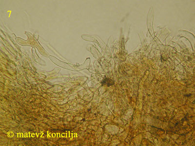 Encoelia fascicularis - medulla