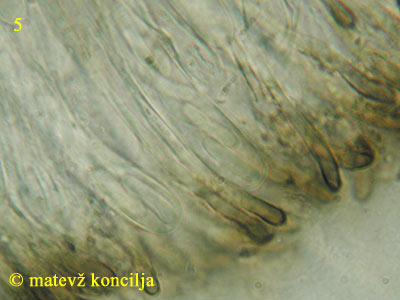 Encoelia fascicularis - parafize