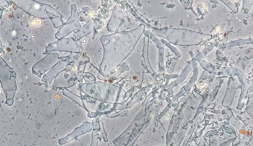 Coprinopsis filamentifera