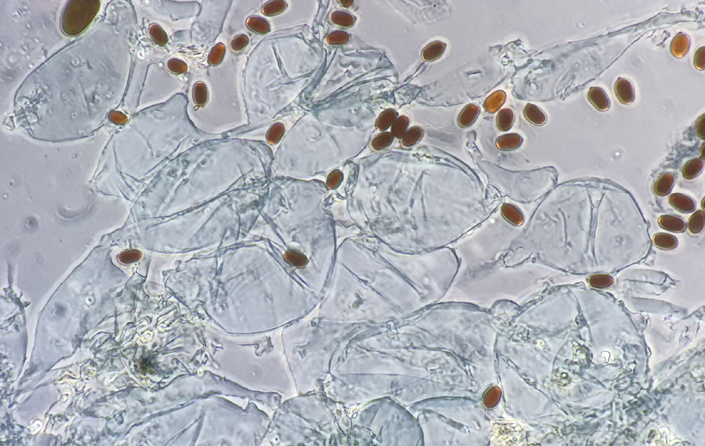 Coprinopsis filamentifera