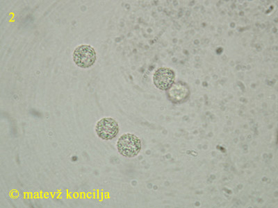 Lycogala flavofuscum - Sporen