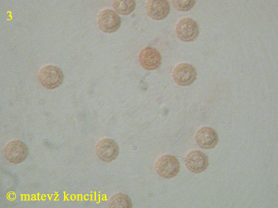 Lycogala flavofuscum - Sporen