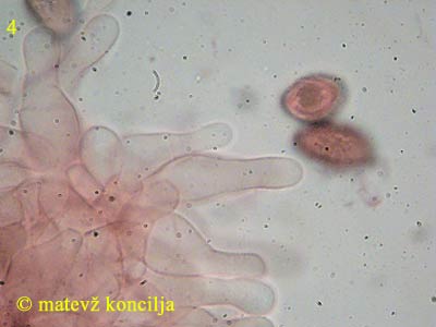 Panaeolina foenisecii - Cheilozystiden