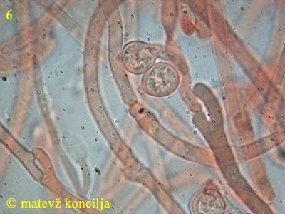 Tremella foliacea - Hyphen