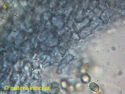 hypocrea gelatinosa - excipulum