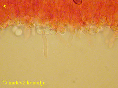 Clitopilus geminus - Cheilozystiden