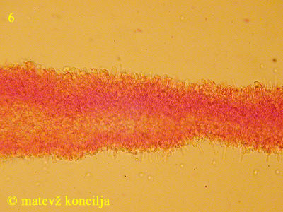 Clitopilus geminus - Cheilozystiden