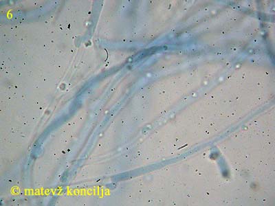 Lyomyces sambuci - Hyphen