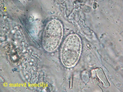 Humaria hemisphaerica - Sporen