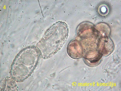 Humaria hemisphaerica - Sporen