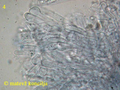 calycina herbarum - excipulum