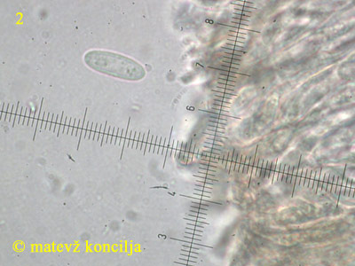 Heterosphaeria patella - Ascosporen