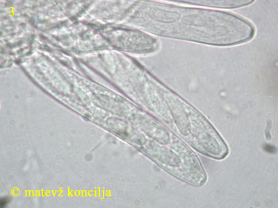 Heterosphaeria patella - Asci