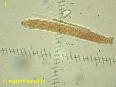 Heterosphaeria patella - Ascus
