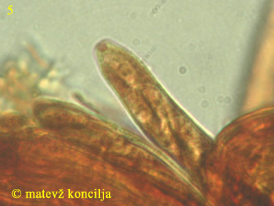 Heterosphaeria patella - Asci