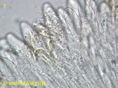 Heterosphaeria patella - Paraphysen mit VBs