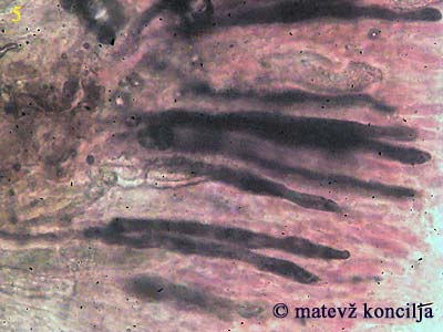 peniophora incarnata - gloiocistide