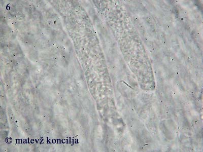 peniophora incarnata - gloiocistide
