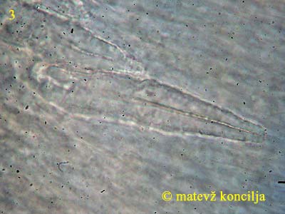 peniophora incarnata - lamprocistide