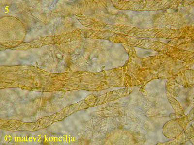 Trichia contorta var. iowensis - Capillitium