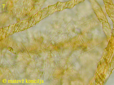 Trichia contorta var. iowensis - notranja plast peridija