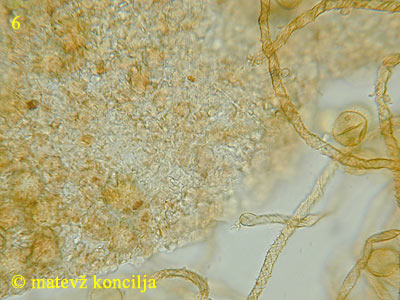 Trichia contorta var. iowensis - zunanja plast peridija