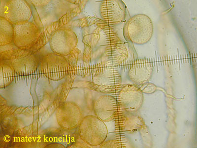 Trichia contorta var. iowensis - Sporen