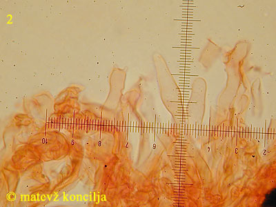 Cylindrobasidium laeve - Basidie