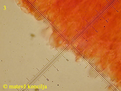 Cylindrobasidium laeve - Basidie