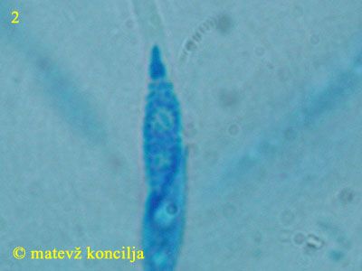 Hypomyces lateritius - askospore