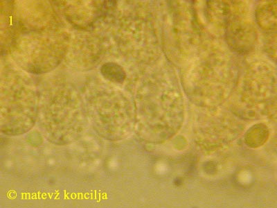 Lepiota lilacea - cistide in trosi