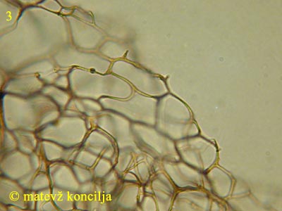 Stemonitis lignicola - Capillitium
